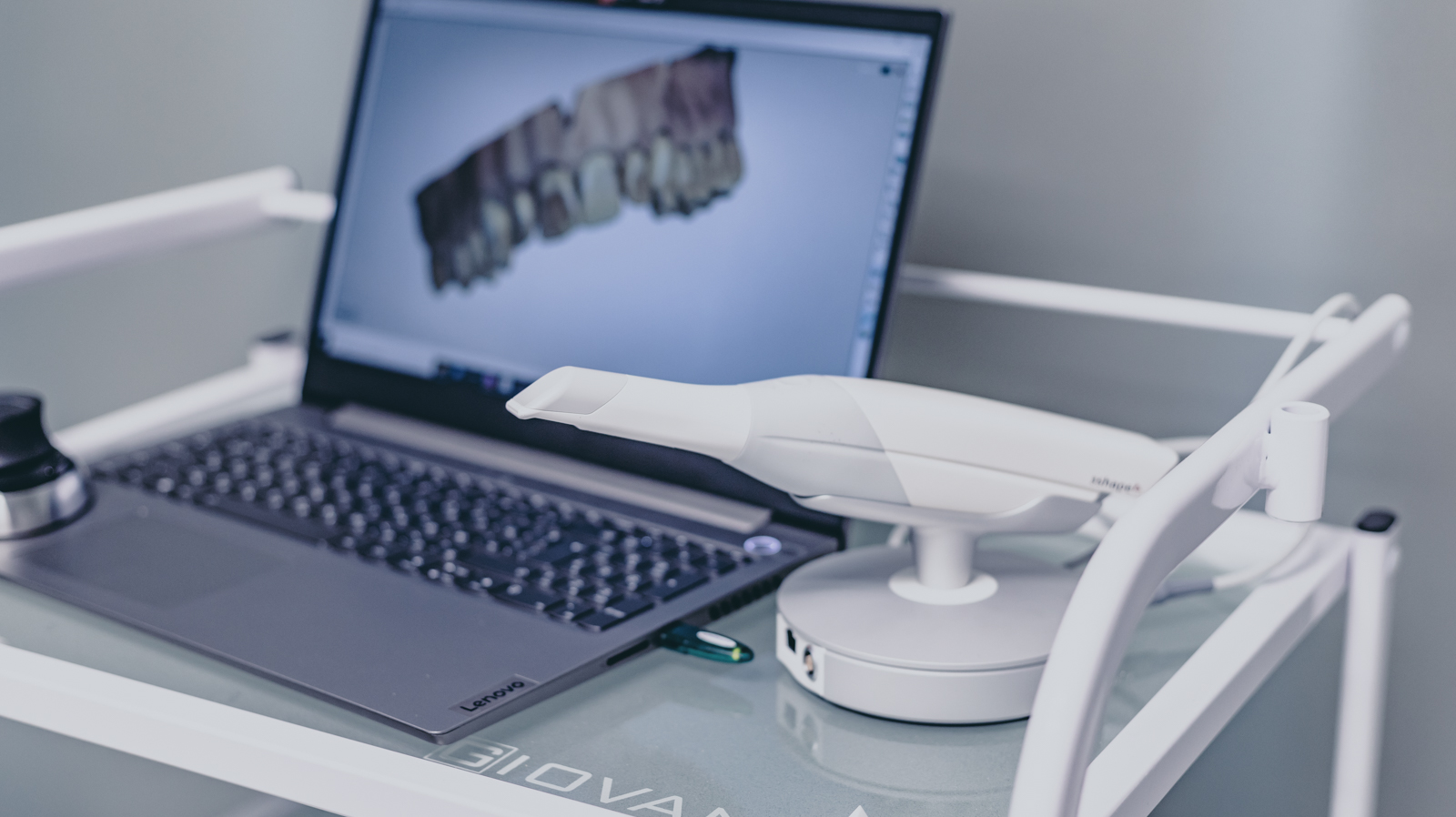 Advantages of the digitalized work process in dental medicine